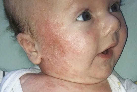 Gel Tắm Gội Oatrum – Combo Tiện Lợi, Tiết Kiệm, An Tâm Cho Cả Nh