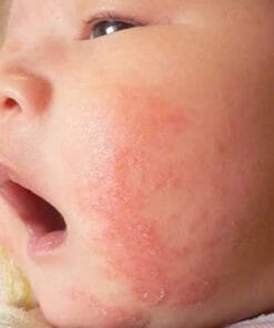 Sản Phẩm Tắm Gội Oatrum – Lành Tính Từ Thảo Dược, Mẹ Yên Tâm Cho Bé