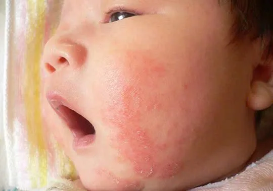 Sản Phẩm Tắm Gội Oatrum – Lành Tính Từ Thảo Dược, Mẹ Yên Tâm Cho Bé